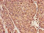 RAI1 Antibody in Immunohistochemistry (Paraffin) (IHC (P))