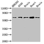 PXK Antibody in Western Blot (WB)