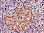 ATG4D Antibody in Immunohistochemistry (Paraffin) (IHC (P))