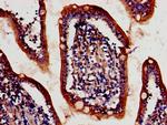 ATG4D Antibody in Immunohistochemistry (Paraffin) (IHC (P))