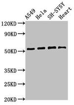 ATG4D Antibody in Western Blot (WB)