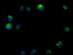 RTN4RL2 Antibody in Immunocytochemistry (ICC/IF)