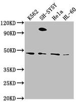 RTN4RL2 Antibody in Western Blot (WB)