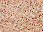 CAND1 Antibody in Immunohistochemistry (Paraffin) (IHC (P))