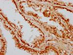 CAND1 Antibody in Immunohistochemistry (Paraffin) (IHC (P))