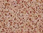 TIPARP Antibody in Immunohistochemistry (Paraffin) (IHC (P))