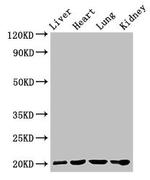 GPIHBP1 Antibody in Western Blot (WB)