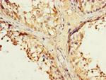 IFNLR1 Antibody in Immunohistochemistry (Paraffin) (IHC (P))