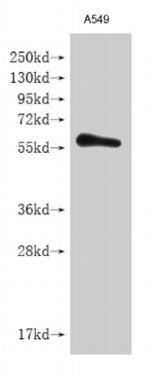 IFNLR1 Antibody in Western Blot (WB)