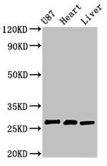 HSCB Antibody in Western Blot (WB)