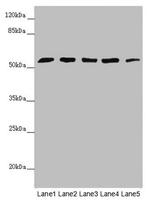 CEP57L1 Antibody in Western Blot (WB)