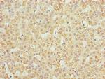 JAGN1 Antibody in Immunohistochemistry (Paraffin) (IHC (P))