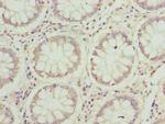 JAGN1 Antibody in Immunohistochemistry (Paraffin) (IHC (P))