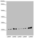 COMMD1 Antibody in Western Blot (WB)