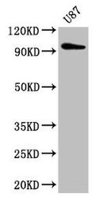 TTLL6 Antibody in Western Blot (WB)