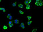 ATP6V0D2 Antibody in Immunocytochemistry (ICC/IF)