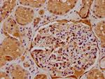 ATP6V0D2 Antibody in Immunohistochemistry (Paraffin) (IHC (P))