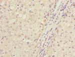 IWS1 Antibody in Immunohistochemistry (Paraffin) (IHC (P))