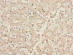 IWS1 Antibody in Immunohistochemistry (Paraffin) (IHC (P))