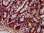 GPT2 Antibody in Immunohistochemistry (Paraffin) (IHC (P))