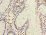 DIS3L Antibody in Immunohistochemistry (Paraffin) (IHC (P))