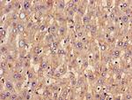 SLC20A1 Antibody in Immunohistochemistry (Paraffin) (IHC (P))