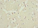 PPP2R1B Antibody in Immunohistochemistry (Paraffin) (IHC (P))