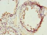 PPP2R1B Antibody in Immunohistochemistry (Paraffin) (IHC (P))