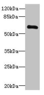 PPP2R1B Antibody in Western Blot (WB)