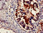 TSR2 Antibody in Immunohistochemistry (Paraffin) (IHC (P))