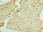 ATGL Antibody in Immunohistochemistry (Paraffin) (IHC (P))