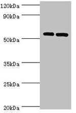 ATGL Antibody in Western Blot (WB)