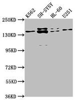 Jouberin Antibody in Western Blot (WB)