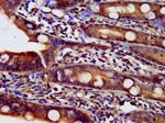 NDUFAF2 Antibody in Immunohistochemistry (Paraffin) (IHC (P))