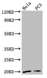 NDUFAF2 Antibody in Western Blot (WB)