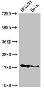 RNaseH2C Antibody in Western Blot (WB)