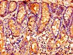 OXER1 Antibody in Immunohistochemistry (Paraffin) (IHC (P))