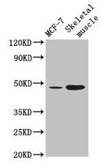 ARRDC3 Antibody in Western Blot (WB)