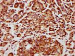 CHST14 Antibody in Immunohistochemistry (Paraffin) (IHC (P))