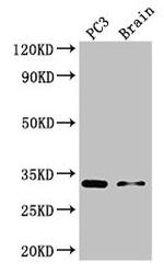 HOXB13 Antibody in Western Blot (WB)