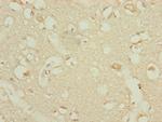 DHTKD1 Antibody in Immunohistochemistry (Paraffin) (IHC (P))