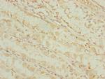 DHTKD1 Antibody in Immunohistochemistry (Paraffin) (IHC (P))