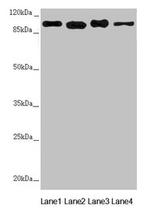 DHTKD1 Antibody in Western Blot (WB)