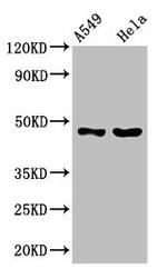 SLC16A11 Antibody in Western Blot (WB)