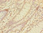 LMO3 Antibody in Immunohistochemistry (Paraffin) (IHC (P))