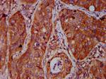 BICD2 Antibody in Immunohistochemistry (Paraffin) (IHC (P))