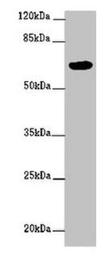 FBXW5 Antibody in Western Blot (WB)