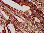 SUCLG2 Antibody in Immunohistochemistry (Paraffin) (IHC (P))