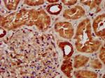 SUCLG2 Antibody in Immunohistochemistry (Paraffin) (IHC (P))