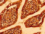 MCU Antibody in Immunohistochemistry (Paraffin) (IHC (P))